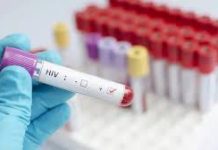 Salta registró 148 casos de VIH en el primer semestre, pero advierten que podrían ser más