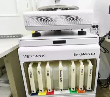 El hospital San Bernardo incorpora un nuevo equipo para fortalecer los diagnósticos oncológicos