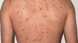 images - 2025-11-25T123627.306