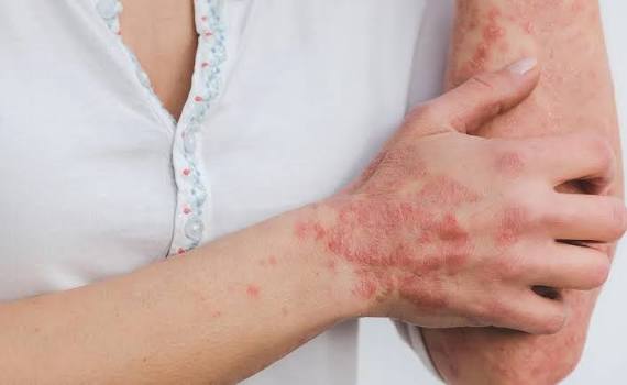 images - 2026-02-13T125041.723