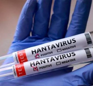 Detectaron hantavirus en un argentino que viajaba por Europa